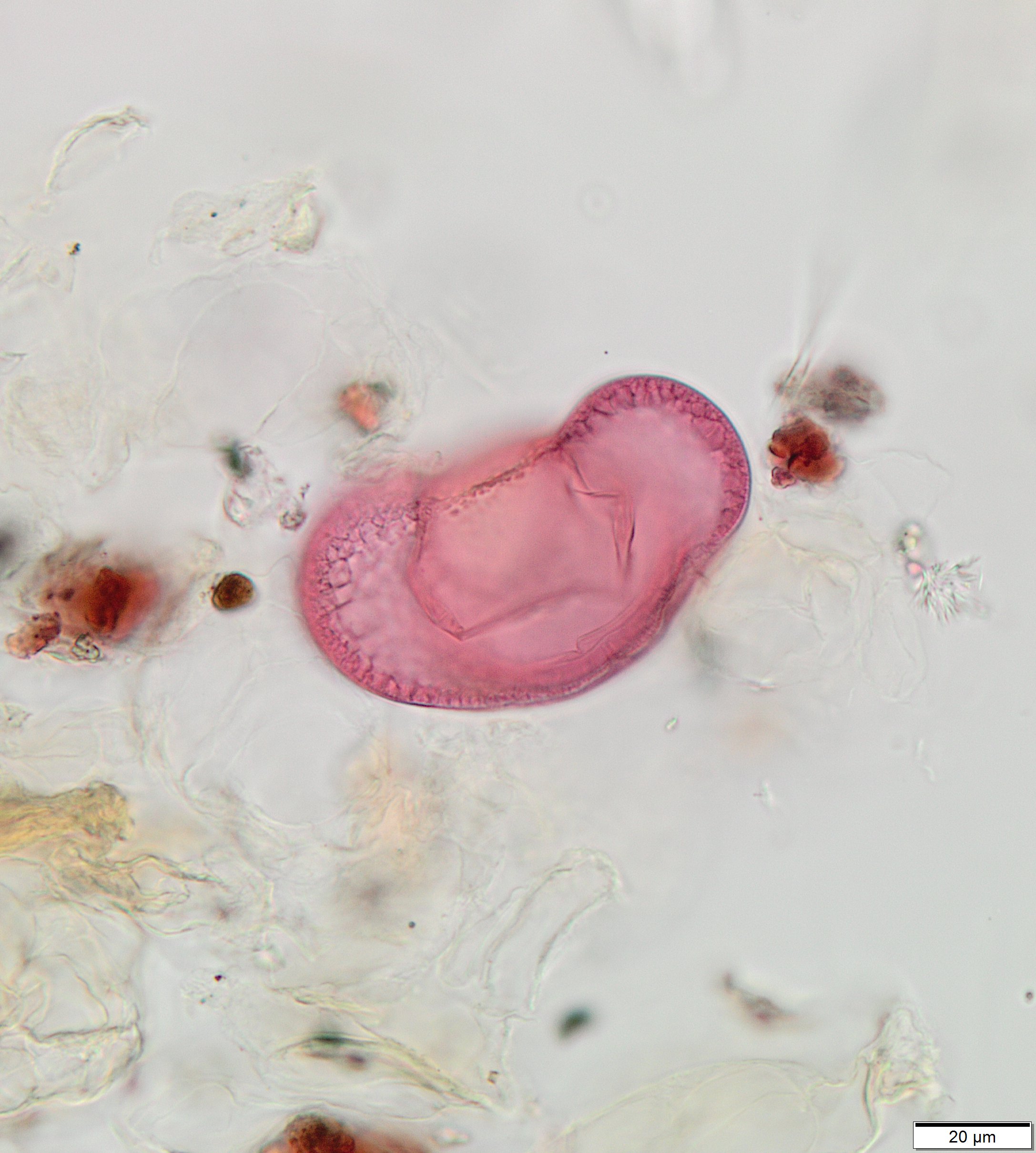 Photo of a microscopic cedar pollen grain found on Baby Doe’s clothing