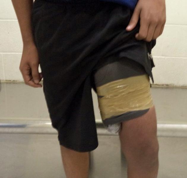 A Nogales teen was found to be carrying a package of heroin taped around his thigh, when he was searched by officers at the Morley pedestrian crossing on Monday.
