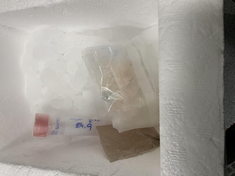 Biological samples seized
